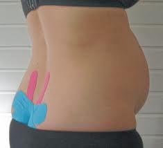 Kinesio-Taping