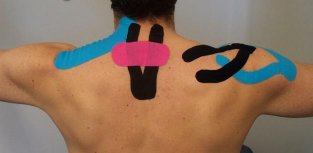 Kinesio-Taping